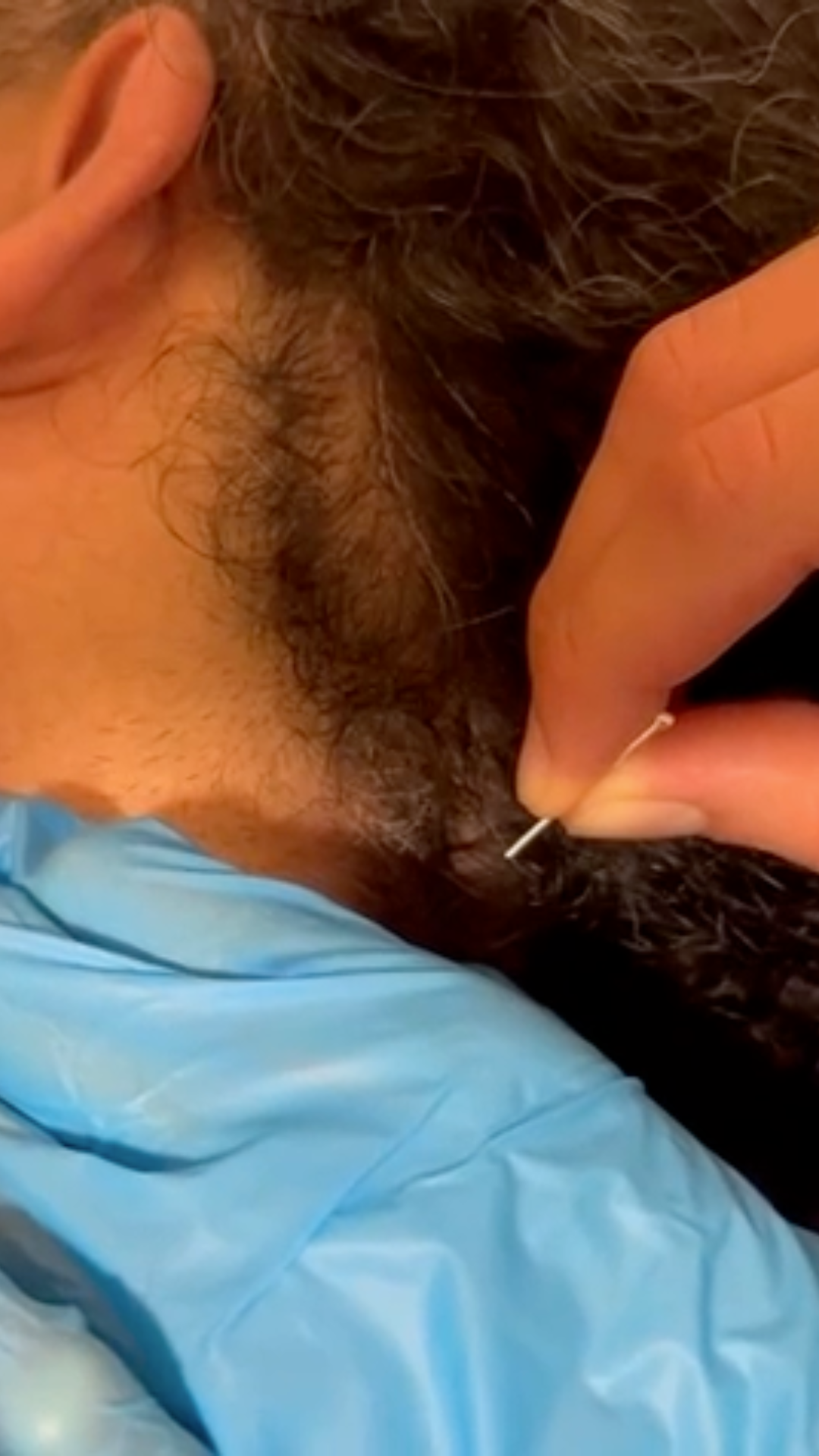 Fisioterapia