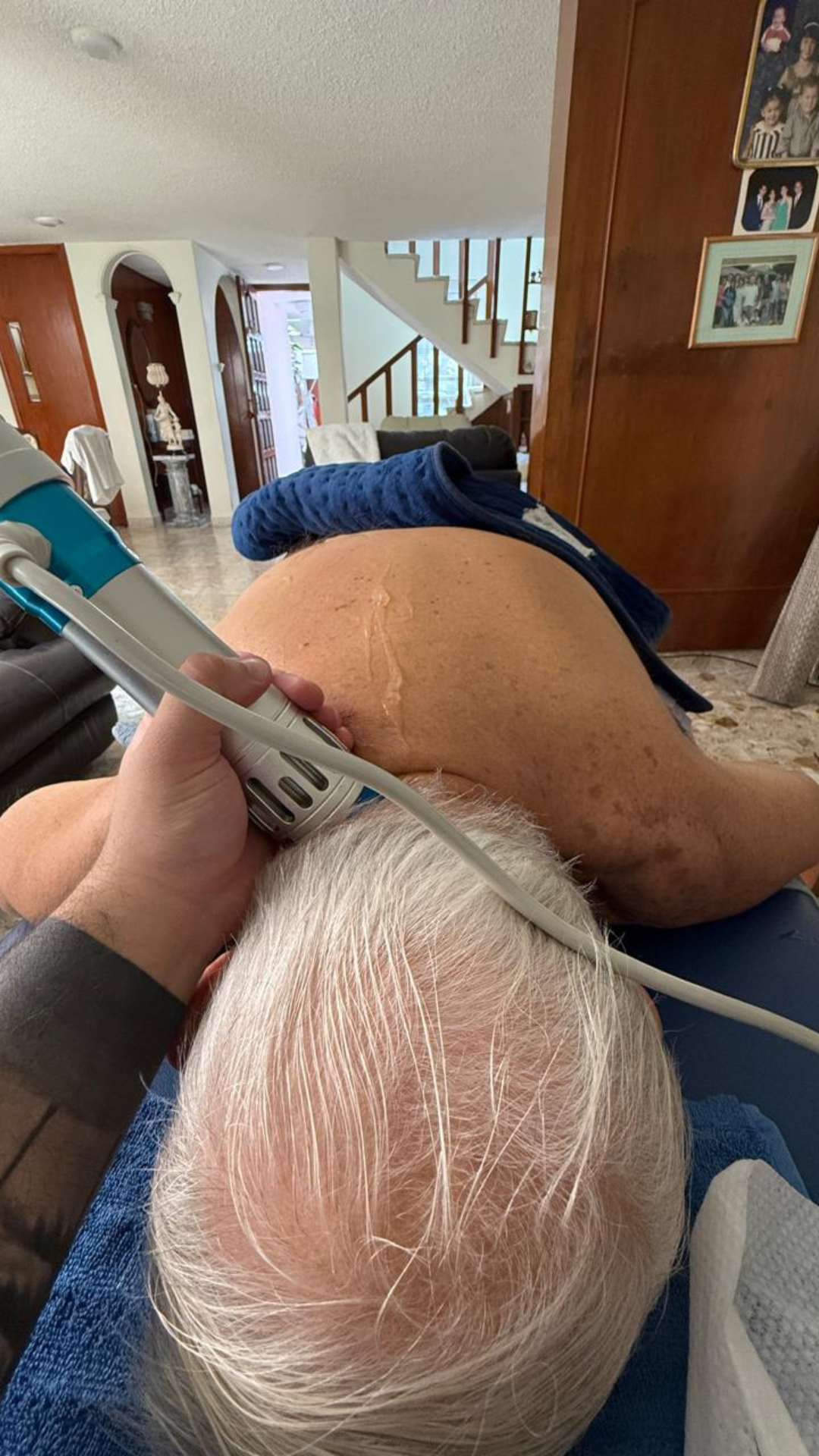 Fisioterapia